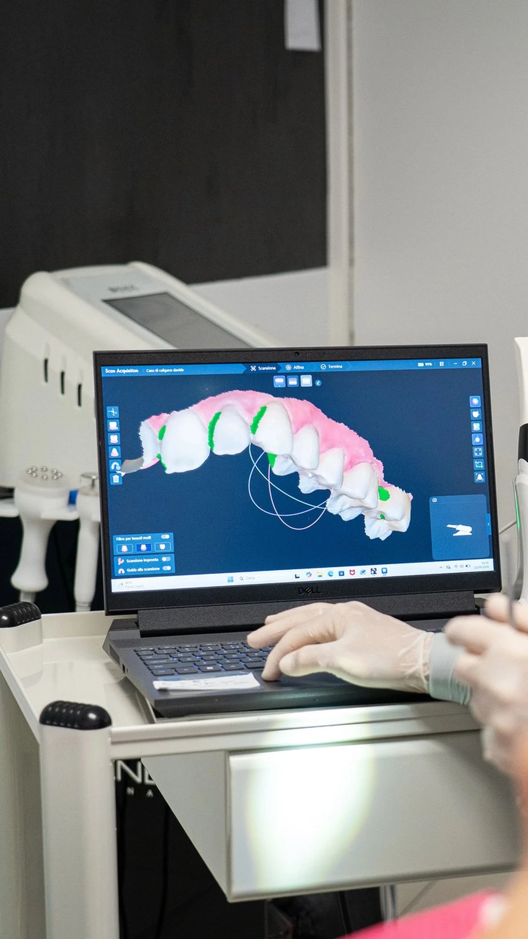 Scansione Digitale Intraorale 3D CM Dental