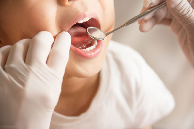 Odontoiatria Pediatrica