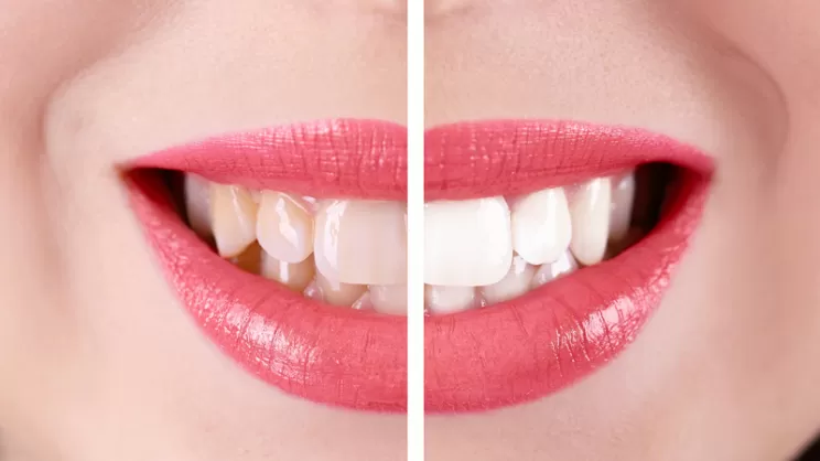 Estetica Dentale